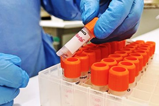 Bahia tem 44 casos da nova varíola