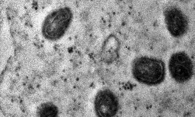 A varíola dos macacos é transmitida pelo vírus monkeypox, que pertence ao gênero orthopoxvirus