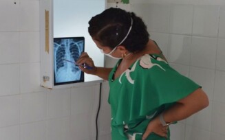 Mais de 80% dos casos de tuberculose tratados evoluíram para cura