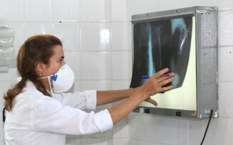 Brasil registra 78 mil novos casos de tuberculose