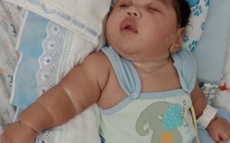 Família pede ajuda para bebê com hidrocefalia, microcefalia e outras sequelas causadas pela meningite