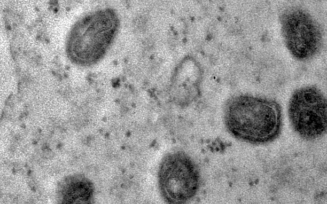 OMS declara fim da emergência em saúde pela varíola dos macacos