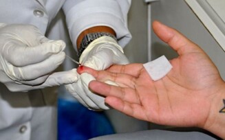 Julho Amarelo: prefeitura intensifica conscientização sobre hepatites virais
