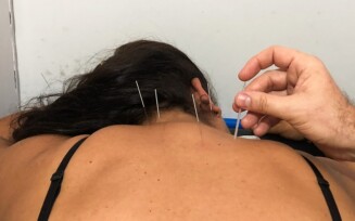 Caps+ 3 também passa a aplicar terapia por acupuntura