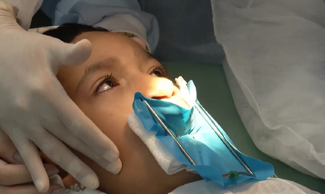 Hospital de Feira de Santana oferecerá cirurgias gratuitas de lábio leporino e fenda palatina
