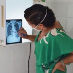 tuberculose - raio X